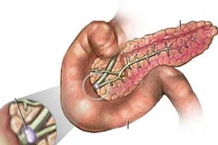 Ảnh chỉ mang tính minh họa. (Nguồn: Internet)
