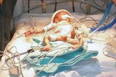 Em bé sau 8 ngày chào đời. (Ảnh: AFP/TTXVN) 