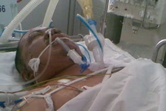 Nhà báo Lê Hoàng Hùng khi được điều trị tại bệnh viện. (Nguồn: Internet)