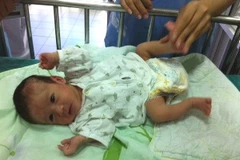 Em bé Vũ Đăng đã hoàn toàn khỏe mạnh. (Ảnh: Thùy Giang/Vietnam+)