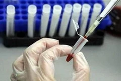 Ảnh chỉ mang tính minh họa. (Nguồn: Internet)