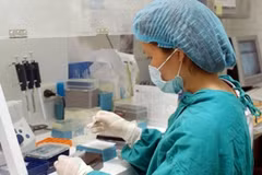Xét nghiệm để phát hiện virus cúm A/H1N1. (Ảnh:TTXVN)