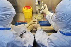 Xét nghiệm các mẫu bệnh phẩm tại phòng thí nghiệm ở tỉnh Tứ Xuyên, Trung Quốc,ngày 15/2. (Ảnh: THX/TTXVN)