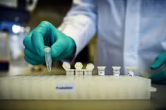Thử nghiệm chế vaccine. (Ảnh: Reuters/TTXVN)