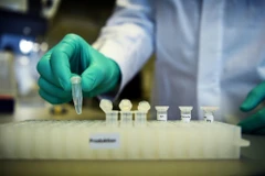 Thử nghiệm chế vaccine. (Ảnh: Reuters/TTXVN)