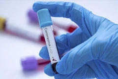 Ấn Độ tạm ngừng xét nghiệm. (Nguồn: aa.com.tr)