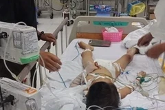 Bé Công được cấp cứu tại bệnh viện Nhi Đồng 2 trong tình trạng hôn mê sâu, nguy kịch. (Ảnh: TTXVN phát)