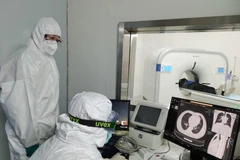 Bác sỹ theo dõi phim chụp CT phổi của bệnh nhân nhiễm COVID-19 tại bệnh viện ở Vũ Hán, Trung Quốc. (Ảnh: THX/TTXVN)