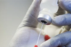 Ảnh chỉ mang tính minh họa. (Nguồn: bebamur.com)