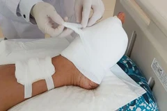 Tai nạn lao động, một người bị lưỡi máy phát cỏ cắt lìa bàn chân