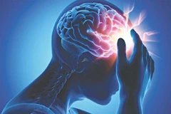 [Video] Cần làm gì để ngăn ngừa đột quỵ sớm ở người trẻ tuổi