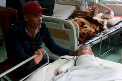 Đắk Nông: Để đèn dầu trong màn, hai mẹ con bị bỏng nặng 