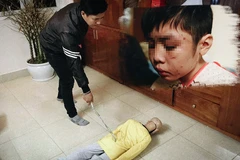 Yêu cầu xử lý nghiêm vụ cháu bé bị bố đẻ và mẹ kế bạo hành