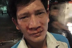 Anh Nguyễn Văn Sinh bị hành hung. (Ảnh Mạnh Khánh/TTXVN)