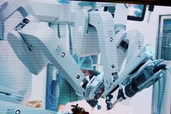 Phẫu thuật nội soi robot tại Bệnh viện Chợ Rẫy. (Ảnh: Phương Vy/TTXVN)