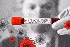 Mẫu bệnh phẩm COVID-19. (Ảnh: IRNA/TTXVN)