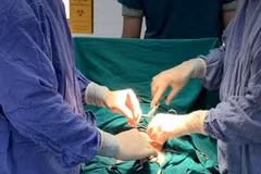 Các bác sỹ Trung tâm Y tế huyện Văn Chấn (Yên Bái) phẫu thuật lấy khối u gần 5kg trong bụng bệnh nhân. (Ảnh: TTXVN phát)