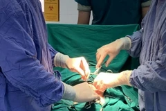 Các bác sỹ Trung tâm Y tế huyện Văn Chấn (Yên Bái) phẫu thuật lấy khối u gần 5kg trong bụng bệnh nhân. (Ảnh: TTXVN phát)