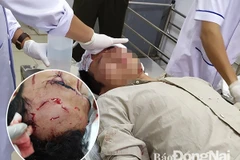 Kiểm lâm Mạc Quý Hùng đang được băng bó vết thương trên đầu. (Ảnh: TTXVN phát)