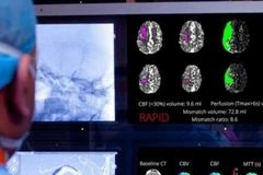 Phần mềm ứng dụng trí tuệ nhân tạo RAPID. 