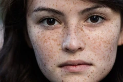 80% thâm nám sẽ quay trở lại khi bạn chọn sai mỹ phẩm