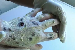 (Nguồn: dailytelegraph.com.au)