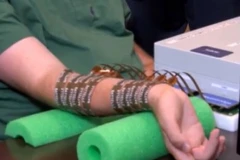 Thiết bị hỗ trợ cử động cơ thể ở bệnh nhân bị liệt bằng ý nghĩ