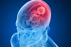 Ảnh minh họa. (Nguồn: isramedic.co.il) 