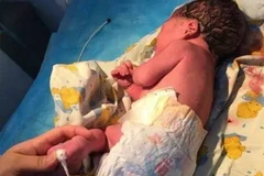 Em bé đang được chăm sóc tại bệnh viện. (Nguồn: xinhuanet.com)