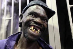 Mison Sere trở thành Nam vương xấu trai ở Zimbabwe. (Nguồn: AP)