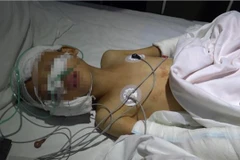 Cậu bé sau khi trải qua ca phẫu thuật. (Nguồn: QQ)