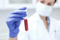 [Video] Phát hiện ra 8 loại ung thư sớm bằng 1 xét nghiệm máu