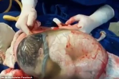 Em bé bọc trong màng ối. (Nguồn: dailymail.co.uk)