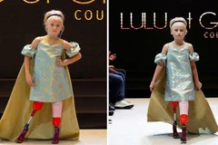 [Video] Mẫu nhí 'không chân' rạng ngời trên sàn catwalk