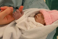 Hope khi vừa chào đời. (Nguồn:mirror)