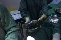 Quả cà tím sau khi được lấy ra ngoài. (Nguồn: Shanghaiist) 