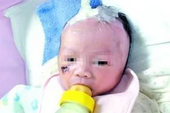 Sự sống của em bé như một kỳ tích. (Nguồn: Chinadaily)