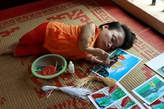 Cao Thị Út, ở xã Tân Thành, huyện Kim Sơn (Ninh Bình) bị di chứng chất độc da cam từ người cha. (Ảnh: Nguyễn Thủy/TTXVN)