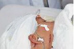 Kinh hoàng mẹ kế chém bé 5 tuổi 50 nhát dao, đứt lìa ngón tay