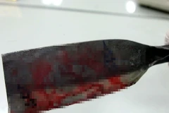 Ảnh minh họa. (Nguồn: appledaily.com.tw)