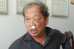 Nhà báo Hoàng Đình Chiểu, phóng viên Đài truyền hình Việt Nam bị hành hung khi đang tác nghiệp. (Nguồn: VTV.vn)