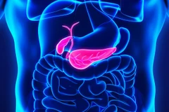 (Nguồn: Medical News Today)