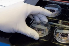 Ảnh chỉ có tính minh họa. (Nguồn: Alamy)