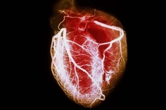 Ảnh chỉ có tính minh họa. (Nguồn: webmd.com)