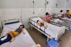 Bốn trẻ bị bỏng trong vụ cháy hiện đang được điều trị tại Bệnh viện Nhi đồng 2. (Nguồn: Báo Công an Nhân dân)
