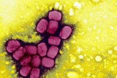 Phát hiện mẫu virus bệnh đậu mùa bị cất giữ trái phép tại Mỹ