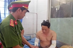 Đối tượng Thụ bị bỏng trên cánh tay. (Ảnh: TTXVN phát)