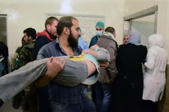 Một em nhỏ bị thương sau vụ nã pháo của quân nổi dậy nhằm phá vỡ vòng vây của quân Chính phủ Syria ở phía đông Aleppo ngày 3/11. (Nguồn: AFP/TTXVN)