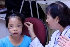 Bình Phước: Bé gái phải khâu hơn 200 mũi do bị chó cắn