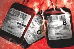 Cảnh báo nguy cơ lây nhiễm viêm gan từ người hiến máu